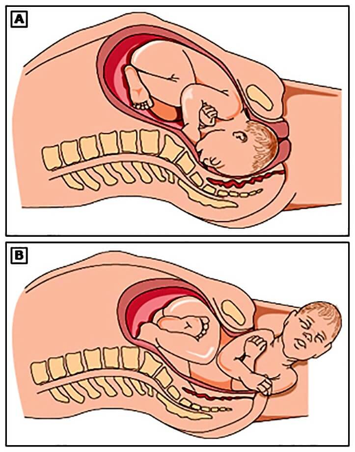 Normal Doğum