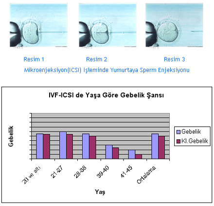 Mikroenjeksiyon Yöntemi